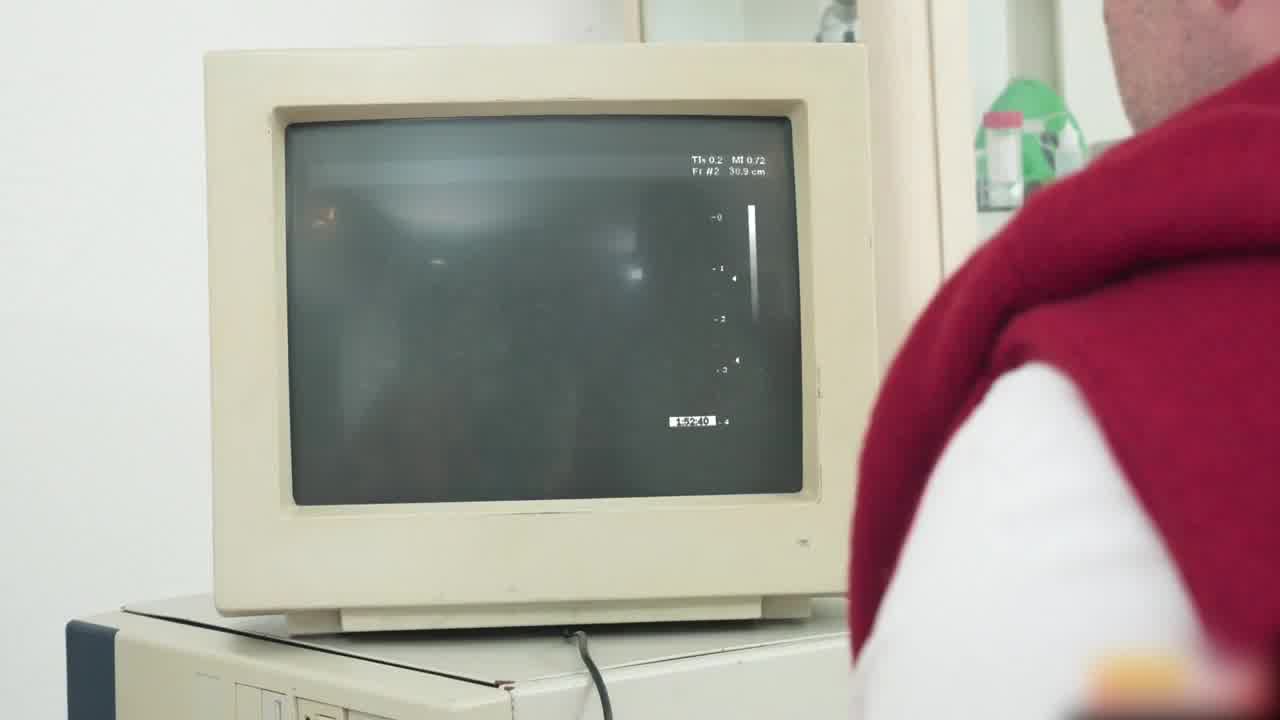  医生在老公面前超音波插入妻子的无毛鲍鱼 的剧照5